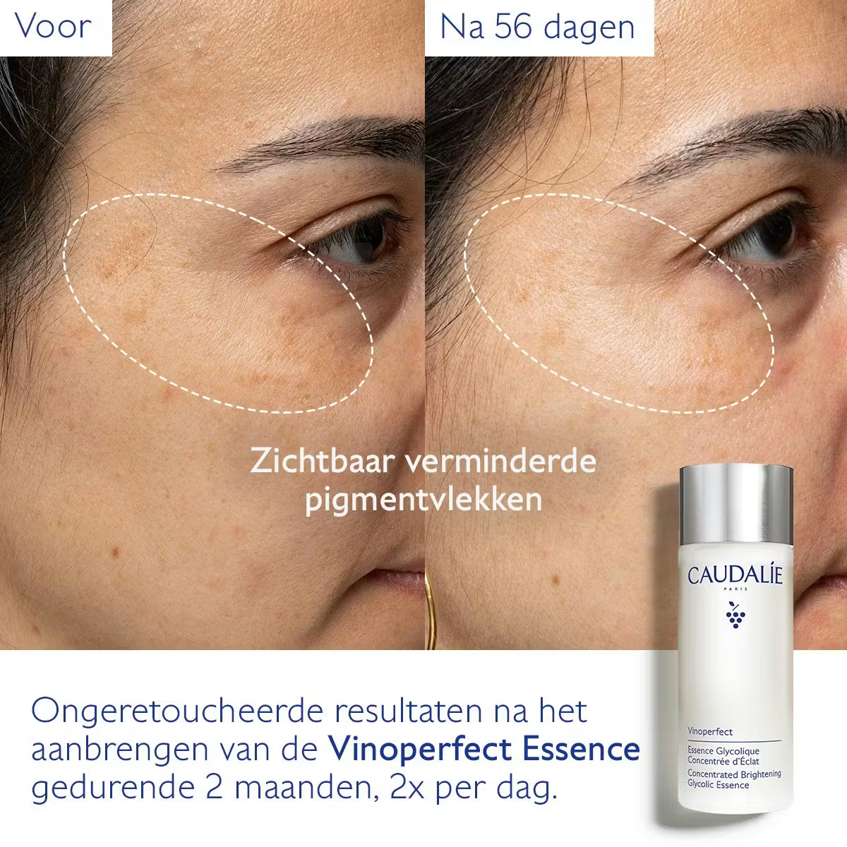 Vinoperfect Essence Glycolic