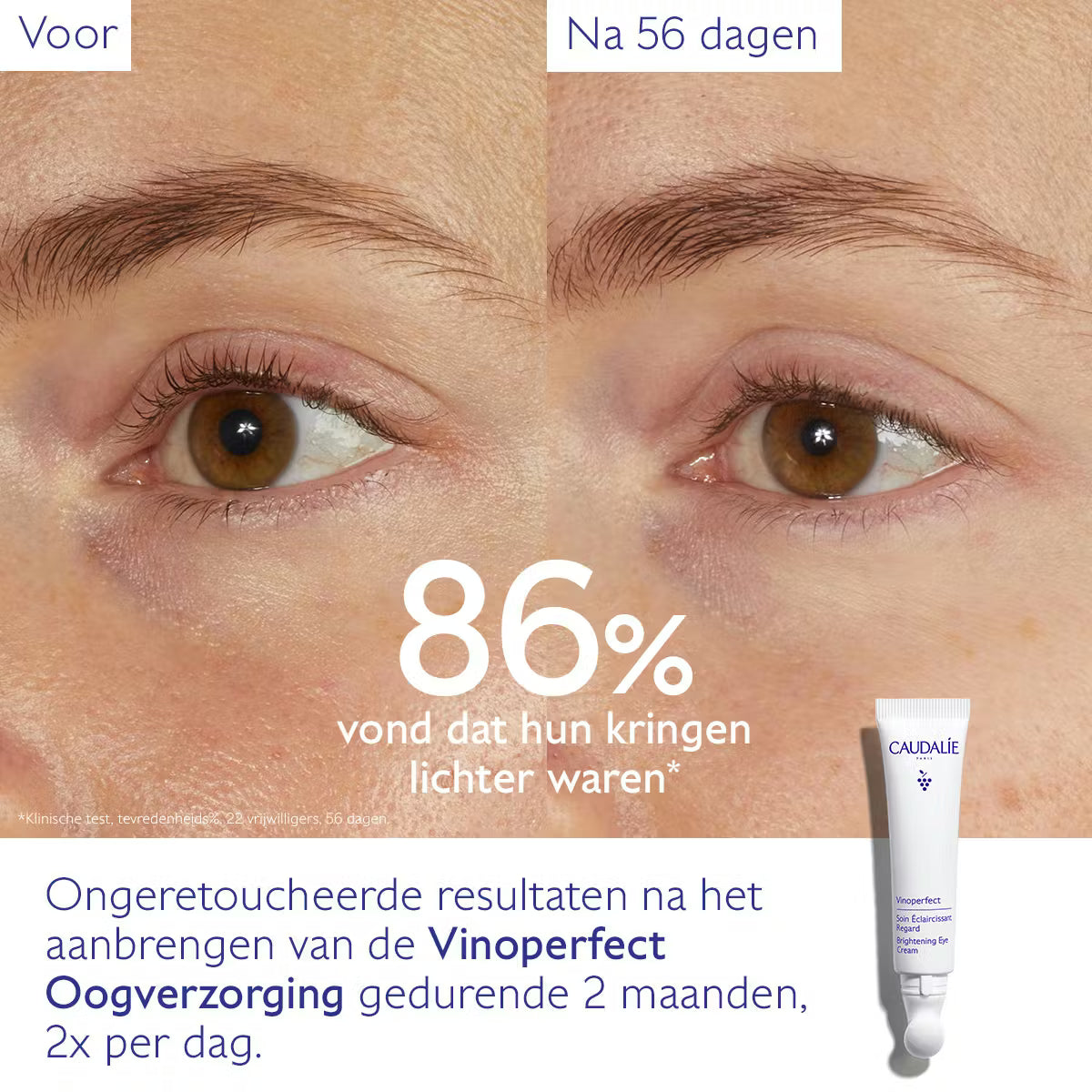Vinoperfect Eye Cream