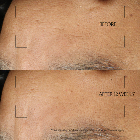 Advanced Night Repair Overnight Treatment