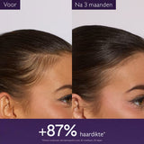 Anti-haaruitval Serum