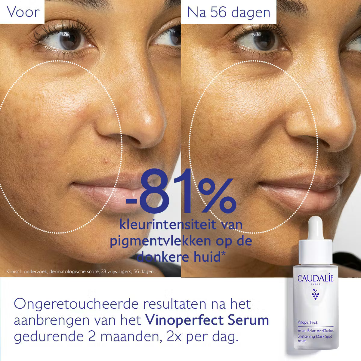 Vinoperfect Serum