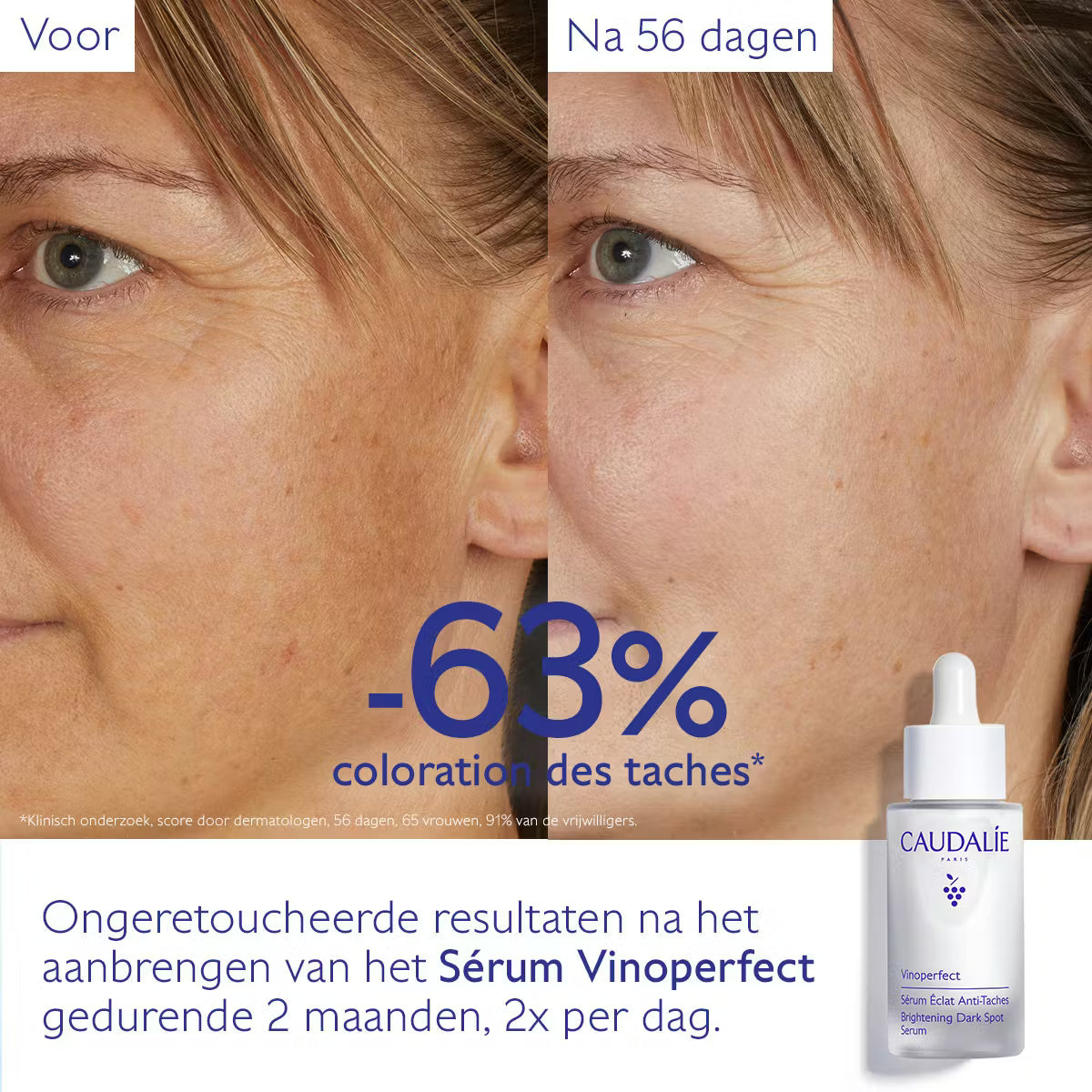 Vinoperfect Serum