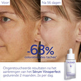 Vinoperfect Serum